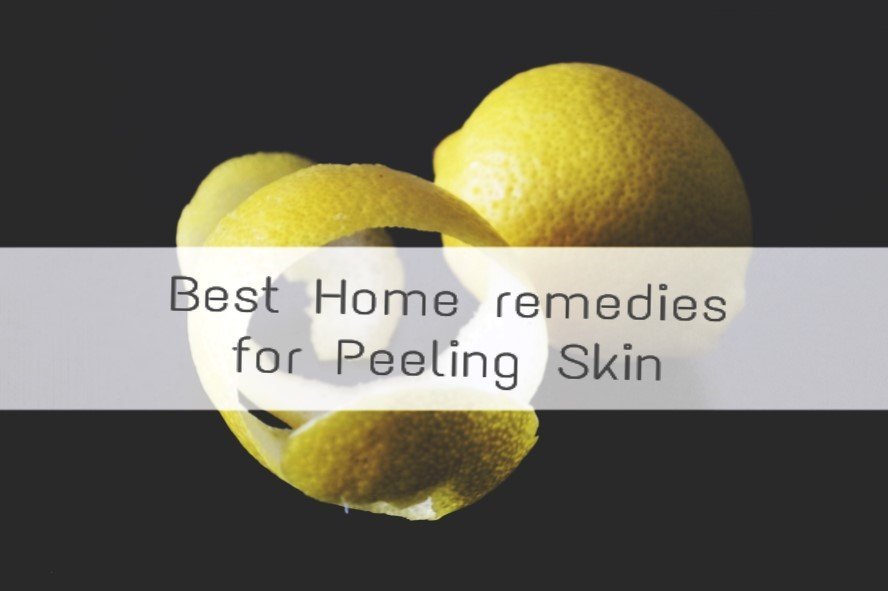 Home remedies for peeling skin